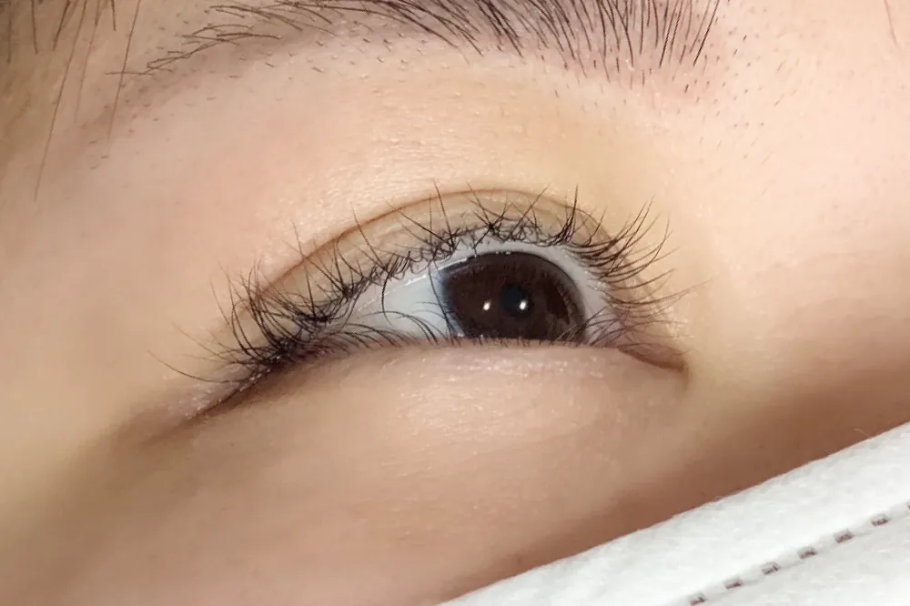 アートメイクアイライン施術前